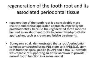 regeneration of the tooth root and its
associated periodontal tissue
• regeneration of the tooth root is a conceivably more
realistic and clinical applicable approach, especially for
prosthodontists, because the regenerated tooth root can
be used as an abutment tooth to permit fixed-prosthetic
approaches, such as crown and bridge treatments.
• Sonoyama et al. demonstrated that a root/periodontal
complex constructed using PDL stem cells (PDLSCs), stem
cells from the apical papilla (SCAP) and a HA/TCP scaffold,
was capable of supporting an artificial crown to provide
normal tooth function in a swine model
 