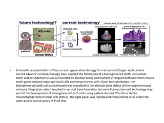 • Schematic representation of the current regenerative strategy for mature tooth/organ replacement.
Recent advances in biotechnology have enabled the fabrication of a bioengineered tooth unit (whole
tooth and periodontal tissues surrounded by alveolar bone) and multiple arranged tooth units from mouse
tooth-germ-derived single epithelial cells and mesenchymal cells. Upon transplantation, the
bioengineered tooth unit (arrowheads) was engrafted in the alveolar bone defect of the recipient mouse
via bone integration, which resulted in vertical bone formation (arrows). Future stem-cell technology may
permit the development of bioengineered tooth units using patient-derived iPS cells or dental
mesenchymal stem/stromal cells (MSCs). The right panel was reproduced from Oshima et al. under the
open-access license policy of PLoS One.
 