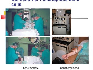 Collection of hematopietic stem
cells
bone marrow peripheral blood
 