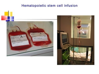 Hematopoietic stem cell infusion
 