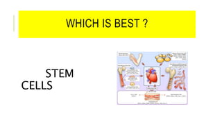 WHICH IS BEST ?
STEM
CELLS
 