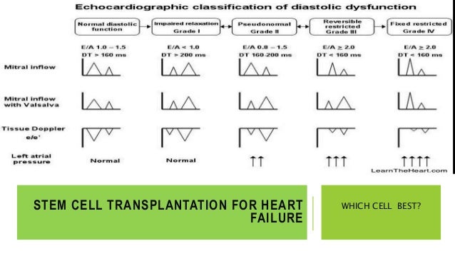 heart diseases and stem cell transplantation Stem cells strengthen the heart the research results are not only relevant for the development of stem cell transplantation as a autoimmune diseases more. heart diseases and stem cell transplantation Stem cells strengthen the heart the research results are not only relevant for the development of stem cell transplantation as a autoimmune diseases more.
