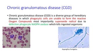 Stem cell transplantation for primary immunodeficiency diseases | PPTX