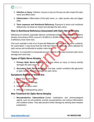 www.advancells.com +91-9654321400
3. Infection or Injury: Infection, trauma or injury to the eye can also impact the optic
nerve and affect vision.
4. Inflammation: Inflammation of the optic nerve, i.e., optic neuritis, also can trigger
ONA.
5. Toxin exposure and Nutritional Deficiency: Exposure to toxins and nutritional
deficiencies can leave an impact and damage the optic nerve.
How is Nutritional Deficiency Associated with Optic Nerve Atrophy
Deficiency of nutrients, especially vitamins, contributes to the development of Optic Nerve
Atrophy. According to WHO, around 2, 50,000 to 5, 00,000 children suffering from vitamin
A deficiency have vision loss.
One such example is that of an 8-year-old Malaysian boy who lost his vision suddenly.
On examination, it was found that the child had vitamin A deficiency, which affected his
optic nerves and contributed to sudden vision loss.
Therefore, it is important to incorporate enough nutrients in the diet to prevent optic nerve
damage and vision loss.
Types of Optic Nerve Atrophy
1. Primary Optic Nerve Atrophy: It is a type where an injury or trauma directly
damages the optic nerve.
2. Secondary Optic Nerve Atrophy: In this type, certain conditions like glaucoma
or optic neuritis indirectly damage the optic nerve.
Symptoms Related to Vision Are:
1. Vision loss or blurry vision
2. Peripheral vision damage
3. Alteration of colour vision
4. Difficulty in distinguishing colour
New Treatment for Optic Nerve Atrophy
• Neuroprotective Interventions: Certain medications and pharmacological
agents, such as anti-oxidants, provide neuroprotection and reduce inflammation
and oxidative stress. They also prevent further damage by slowing down disease
progression.
 