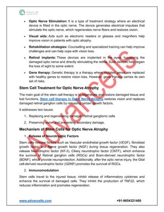 www.advancells.com +91-9654321400
• Optic Nerve Stimulation: It is a type of treatment strategy where an electrical
device is fitted in the optic nerve. The device generates electrical impulses that
stimulate the optic nerve, which regenerates nerve fibers and restores vision.
• Visual aids: Aids such as electronic readers or glasses and magnifiers help
improve vision in patients with optic atrophy.
• Rehabilitation strategies: Counselling and specialized training can help improve
challenges and can help cope with vision loss.
• Retinal implants: These devices are implanted in the eyes, bypassing the
damaged optic nerve and directly stimulating the retina. Such devices help regain
the loss of sight to some extent.
• Gene therapy: Genetic therapy is a therapy where mutated genes are replaced
with healthy genes to restore vision loss. However, gene therapy carries its own
set of risks.
Stem Cell Treatment for Optic Nerve Atrophy
The main goal of the stem cell therapy is to regenerate and restore damaged tissue and
lost functions. Stem cell therapy in Optic Nerve Atrophy restores vision and replaces
damaged retinal ganglion cells by releasing certain growth factors.
It addresses two issues:
1. Replacing and regenerating damaged retinal ganglionic cells
2. Preserving vision and preventing secondary damage.
Mechanism of Stem Cells for Optic Nerve Atrophy
1. Release of Neurotrophic Factors
Stem cells release factors such as Vascular endothelial growth factor (VEGF), fibroblast
growth factor, and Nerve growth factor (NGF) during tissue regeneration. They also
release Neurotrophic factor (NT-3), Ciliary neurotrophic factor (CNTF), which enhance
the survival of Retinal ganglion cells (RGCs) and Brain-derived neurotrophic factor
(BDNF), which provide neuroprotection. Additionally, after the optic nerve injury, the Glial
cell-derived neurotrophic factor (GDNF) promotes the survival of RGCs.
2. Immunomodulation
Stem cells travel to the injured tissue, inhibit release of inflammatory cytokines and
enhance the survival of damaged cells. They inhibit the production of TNF22, which
reduces inflammation and promotes regeneration.
 