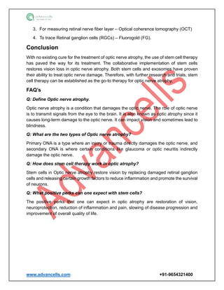 www.advancells.com +91-9654321400
3. For measuring retinal nerve fiber layer – Optical coherence tomography (OCT)
4. To trace Retinal ganglion cells (RGCs) – Fluorogold (FG).
Conclusion
With no existing cure for the treatment of optic nerve atrophy, the use of stem cell therapy
has paved the way for its treatment. The collaborative implementation of stem cells
restores vision loss in optic nerve atrophy. Both stem cells and exosomes have proven
their ability to treat optic nerve damage. Therefore, with further research and trials, stem
cell therapy can be established as the go-to therapy for optic nerve atrophy.
FAQ’s
Q: Define Optic nerve atrophy.
Optic nerve atrophy is a condition that damages the optic nerve. The role of optic nerve
is to transmit signals from the eye to the brain. It is also known as optic atrophy since it
causes long-term damage to the optic nerve. It can impact vision and sometimes lead to
blindness.
Q: What are the two types of Optic nerve atrophy?
Primary ONA is a type where an injury or trauma directly damages the optic nerve, and
secondary ONA is where certain conditions like glaucoma or optic neuritis indirectly
damage the optic nerve.
Q: How does stem cell therapy work in optic atrophy?
Stem cells in Optic nerve atrophy restore vision by replacing damaged retinal ganglion
cells and releasing certain growth factors to reduce inflammation and promote the survival
of neurons.
Q: What positive perks can one expect with stem cells?
The positive perks that one can expect in optic atrophy are restoration of vision,
neuroprotection, reduction of inflammation and pain, slowing of disease progression and
improvement of overall quality of life.
 