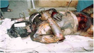 Most chemical reactions can be classified
into five types:
1. Decomposition reaction – a reactant
breaks down into two or more products
 