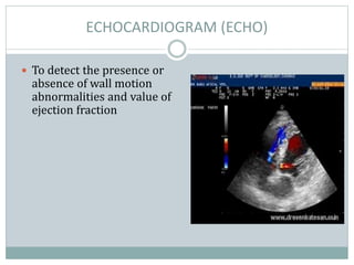 Stemi | PPTX