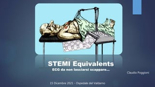 STEMI Equivalents
ECG da non lasciarsi scappare…
Claudio Poggioni
15 Dicembre 2021 - Ospedale del Valdarno
 