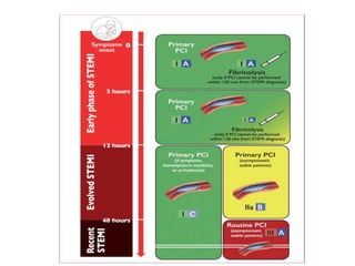 Pvc And Stemi Stemi guideline esc 2017 | PPTX