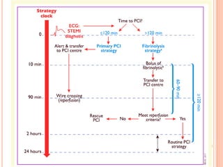 ppt on STEMI IN ICU, FOR acute coronary syndrome | PPTX
