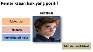 Pemeriksaan fisik yang positif
ILUSTRASI

Takikardia
Takipnea
Rhonki basah halus
Tatto a/r cruris bilateral

 