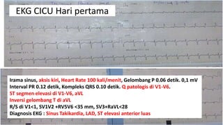 EKG CICU Hari pertama

Irama sinus, aksis kiri, Heart Rate 100 kali/menit, Gelombang P 0.06 detik. 0,1 mV
Interval PR 0.12 detik, Kompleks QRS 0.10 detik. Q patologis di V1-V6.
ST segmen elevasi di V1-V6, aVL
Inversi gelombang T di aVL
R/S di V1<1, SV1V2 +RV5V6 <35 mm, SV3+RaVL<28
Diagnosis EKG : Sinus Takikardia, LAD, ST elevasi anterior luas

 