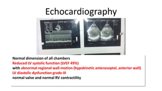 Echocardiography

Normal dimension of all chambers
Reduced LV systolic function (LVEF 49%)
with abnormal regional wall motion (hypokinetic anteroseptal, anterior wall)
LV diastolic dysfunction grade III
normal valve and normal RV contractility

 