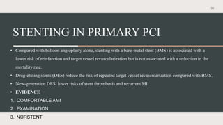 Multiple Pvc Vs Stemi STEMI PPT for acute coronary syndome acute MI | PPTX