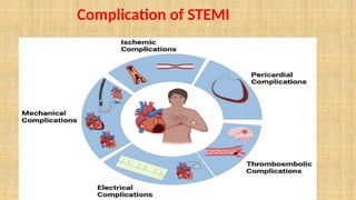 Stemi Program lecture on STEMI protocol IN Emergency room | PPTX