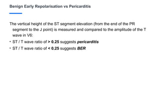 Benign Early Repolarisation vs Pericarditis
The vertical height of the ST segment elevation (from the end of the PR
segment to the J point) is measured and compared to the amplitude of the T
wave in V6:
• ST / T wave ratio of > 0.25 suggests pericarditis
• ST / T wave ratio of < 0.25 suggests BER
 