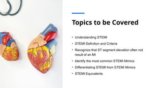 Topics to be Covered
• Understanding STEMI
• STEMI Definition and Criteria
• Recognize that ST segment elevation often not
result of an MI
• Identify the most common STEMI Mimics
• Differentiating STEMI from STEMI Mimics
• STEMI Equivalents
 