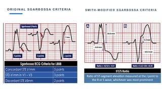 O R I G I N A L S G A R B O S S A C R I T E R I A S M I T H - M O D I F I E D S G A R B O S S A C R I T E R I A
 