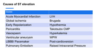 Causes of ST elevation
Causes
Acute Myocardial Infarction LVH
Global ischemia Brugada
Early Repolarization Hypothermia
Pericarditis Takotsubo CMP
Vasospasm Hyperkalemia
Ventricular aneurysm WPW
LBBB/ Pacemaker Post-cardioversion
Pulmonary Embolism Raised Intracranial Pressure
 