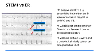 STEMI vs ER
•To achieve dx BER, it is
essential to have either an S-
wave or a J-wave present in
both V2 and V3.
•If V2 does not exhibit either an
S-wave or a J-wave, it cannot
be classified as BER.
•If V3 lacks both an S-wave and
a J-wave, it similarly cannot be
categorized as BER.
 