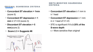 O R I G I N A L S G A R B O S S A C R I T E R I A
• Concordant ST elevation > 1mm
(score 5)
• Concordant ST depression > 1
mm in V1-V3 (score 3)
• Discordant ST elevation > 5
mm(score 2)
• Score ≥ 3 = Suggests MI
S M I T H - M O D I F I E D S G A R B O S S A
C R I T E R I A
• Concordant ST elevation ≥ 1 mm in
≥ 1 lead
• Concordant ST depression ≥ 1 mm
in ≥ 1 lead of V1-V3
• STE is significant if it’s ≥ 25% of the
S-wave depth
More sensitive than original
👉
 