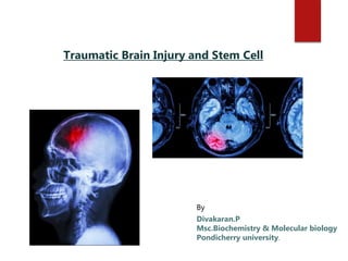 By
Divakaran.P
Msc.Biochemistry & Molecular biology
Pondicherry university.
Traumatic Brain Injury and Stem Cell
 