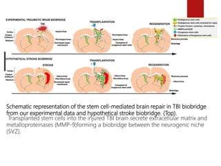 stem cell and Traumatic brain injury | PPTX