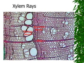 Xylem Rays
 