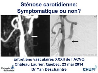 Entretiens vasculaires XXXII de l’ACVQ
Château Laurier, Québec, 23 mai 2014
Dr Yan Deschaintre
Sténose carotidienne:
Symptomatique ou non?
Cosottini et al. Stroke 2003; 34: 660-64
 
