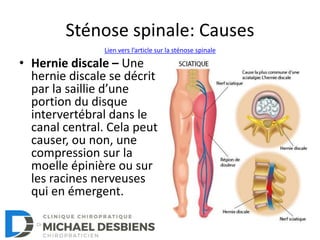 Sténose spinale: Causes
• Hernie discale – Une
hernie discale se décrit
par la saillie d’une
portion du disque
intervertébral dans le
canal central. Cela peut
causer, ou non, une
compression sur la
moelle épinière ou sur
les racines nerveuses
qui en émergent.
Lien vers l’article sur la sténose spinale
 