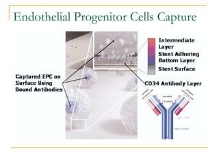 Endothelial Progenitor Cells Capture
 