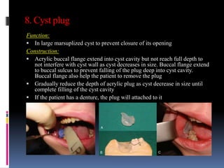 8. Cyst plug
Function:
 In large marsuplized cyst to prevent closure of its opening
Construction:
 Acrylic buccal flange extend into cyst cavity but not reach full depth to
not interfere with cyst wall as cyst decreases in size. Buccal flange extend
to buccal sulcus to prevent falling of the plug deep into cyst cavity.
Buccal flange also help the patient to remove the plug
 Gradually reduce the depth of acrylic plug as cyst decrease in size until
complete filling of the cyst cavity
 If the patient has a denture, the plug will attached to it
 