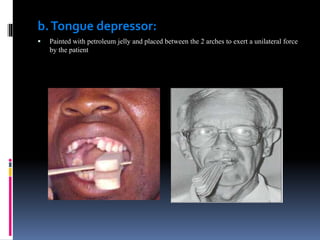 b.Tongue depressor:
 Painted with petroleum jelly and placed between the 2 arches to exert a unilateral force
by the patient
 