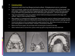  Construction:
 Impression with short tray flange (occlusal surface) - If displacement occurs, sectioned
 Cast is surveyed, undercuts were blocked out, wax on the occlusal surface of the teeth - the
articulator is closed for imprints of opposing teeth. Wax not interfere with free way space
Cusps of teeth may perforate the wax to decrease jaw separation , cement escapement
 Tags are embedded in the wax pattern which hold wire loop (screwed to the tags with
screw) - help in intermaxillary fixation
 Wax pattern is invested and casted with direct (over the cast) or indirect (removed from the
cast to verify that undercut is blocked to avoid interference during insertion casting) system
 Cement the splints on the corresponding teeth, apply traction force - Wire loops screwed to the tags, use
quick setting plaster (in reduced state), invested , connected by metal bar
 Reduce the fracture again, the wire loops with connecting bar screwed to the tags
 Other method used to connect the 2 pieces metal cap splint using metal rode and metal tube
 