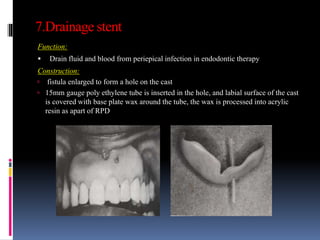7.Drainage stent
Function:
 Drain fluid and blood from periepical infection in endodontic therapy
Construction:
 fistula enlarged to form a hole on the cast
 15mm gauge poly ethylene tube is inserted in the hole, and labial surface of the cast
is covered with base plate wax around the tube, the wax is processed into acrylic
resin as apart of RPD
 