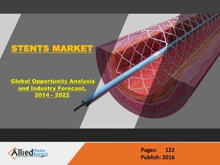 STENTS MARKET
Global Opportunity Analysis
and Industry Forecast,
2014 - 2022
Pages: 122
Publish: 2016
 