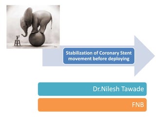 Stabilization of Coronary Stent
movement before deploying
Dr.Nilesh Tawade
FNB
 