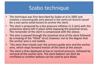 Szabo technique
• The technique was first described by Szabo et al in 2005 and
involves a second guide wire placed in the aorta (or branch vessel
for a non aorto-ostial lesion) to anchor the stent.
• The stent is prepared by a low pressure inflation (1-2 atm) with the
protective sleeve left in place while exposing the proximal struts.
The remainder of the stent is compressed with the sleeve.
• The wire is passed through the proximal strut of the stent followed
by crimping of the “lifted” strut; however, not to the degree that
the anchor wire is not mobile.
• The stent then travels over the primary guide wire and the anchor
wire, which stops forward motion of the stent at the ostium
• The stent is then deployed at low or nominal pressure, followed by
removal of the anchor wire. The stent balloon can then be
reinflated or another balloon can be used to post dilate.
 