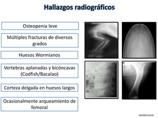 Hallazgos radiográficos 
Osteopenia leve 
Múltiples fracturas de diversos 
grados 
Huesos Wormianos 
Vertebras aplanadas y bicóncavas 
(Codfish/Bacalao) 
Corteza delgada en huesos largos 
Ocasionalmente arqueamiento de 
femoral 
OMIM#166200 
 