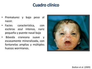 Cuadro clínico 
• Prematurez y bajo peso al 
nacer. 
• Facies característica, con 
escleras azul intenso, nariz 
pequeña y puente nasal bajo 
• Bóveda craneana suave y 
escasamente mineralizada, con 
fontanelas amplias y múltiples 
huesos wormianos. 
Bodian et al. (2009) 
 