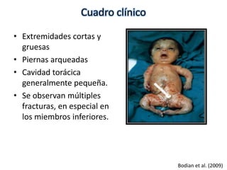 • Extremidades cortas y 
gruesas 
• Piernas arqueadas 
• Cavidad torácica 
generalmente pequeña. 
• Se observan múltiples 
fracturas, en especial en 
los miembros inferiores. 
Bodian et al. (2009) 
Cuadro clínico 
 