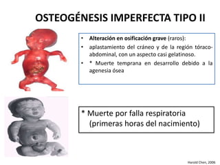 OSTEOGÉNESIS IMPERFECTA TIPO II 
• Alteración en osificación grave (raros): 
• aplastamiento del cráneo y de la región tóraco-abdominal, 
con un aspecto casi gelatinoso. 
• * Muerte temprana en desarrollo debido a la 
agenesia ósea 
* Muerte por falla respiratoria 
(primeras horas del nacimiento) 
Harold Chen, 2006 
 