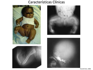 Harold Chen, 2006 
Características Clínicas 
 