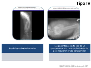 Puede haber laxitud articular 
Tipo IV 
Los pacientes con este tipo de OI 
generalmente son capaces de deambular, 
pero requieren ayuda para caminar. 
POSSUM 2012; INP. 2009; Hernández y cols. 2007 
 
