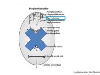 Fratzl-Zelman et al., 2010; Moul et al.,  