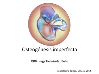 Osteogénesis imperfecta 
QBB. Jorge Hernández Bello 
Guadalajara, Jalisco, México. 2014 
 