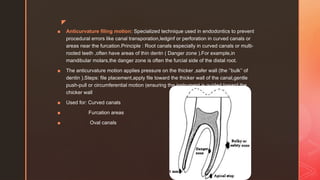 Step-back technique of root canal preparation.pptx