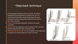 Step Then Root Step-back technique of root canal preparation.pptx