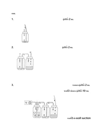 เฉลย.

1.       จุมใตนา 2 ซม.
                 ้ํ




2.      จุมใตน้ํา 2 ซม.




3.                      ขวดกลางจุมใตนา 2 ซม.
                                       ้ํ

          ขวดที่3 ทอกลาง จุมใตน้ํา 10 ซม.




                ขวดที3 ตอ wall suction
                     ่



                                               34
 